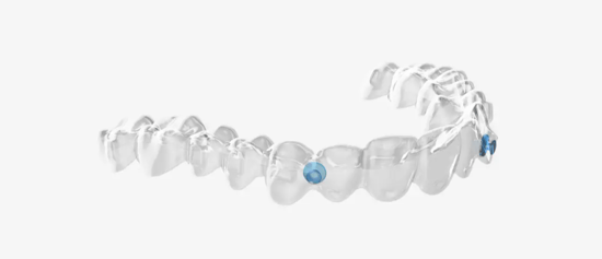Angel aligners offer discreet teeth straightening at Elmsleigh House Dental Clinic