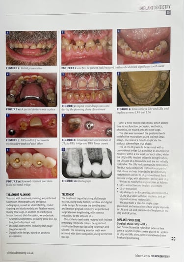 Kit Dentistry implants3