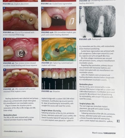 Kit Dentistry implants4-1