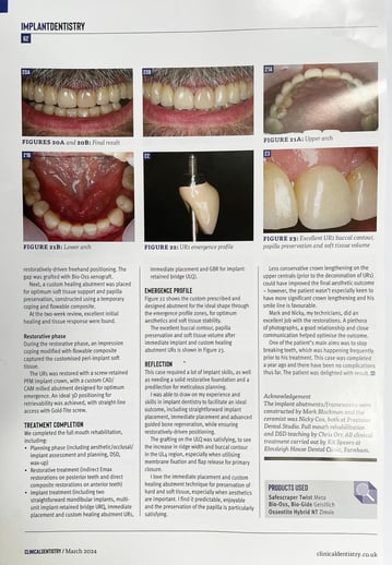 Kit Dentistry implants5