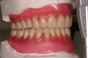 Mrs W trial teeth
