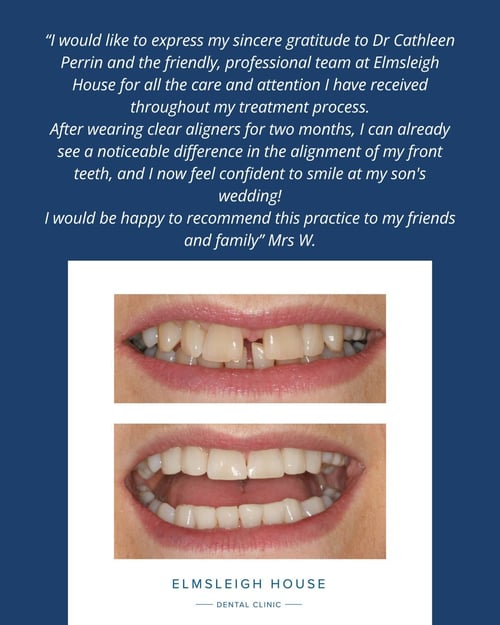 Mrs W testimonial following Cfast clear aligners, whitening and cosmetic bonding at Elmsleigh House Dental Clinic in Farnham