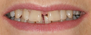 Mrs W Smile before