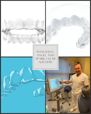 Specialist orthodontist, Kostas Spathoulas, offers Invisalign, Angel and Spark clear aligners to straighten teeth or correct the bite at Elmsleigh House Dental Clinic in Farnham
